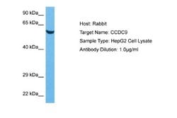CCDC9 Rabbit anti-Human, Polyclonal, Novus Biologicals 0.1 mL | Buy Online | Novus Biologicals | Fisher Scientific